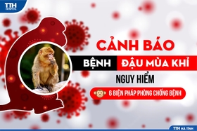 Bộ Y tế hướng dẫn triệu chứng nghi ngờ và cách phòng bệnh đậu mùa khỉ