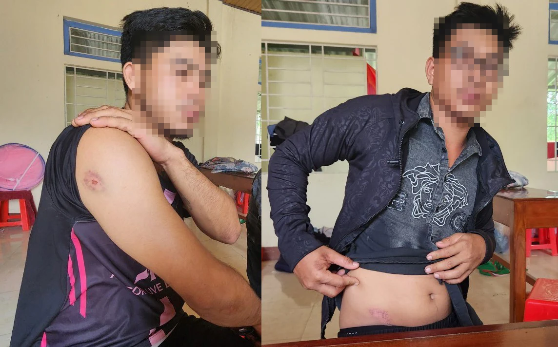  3 thanh niên người Hậu Giang lái máy gặt lúa thuê bị hành hung ở xã Triệu Thượng