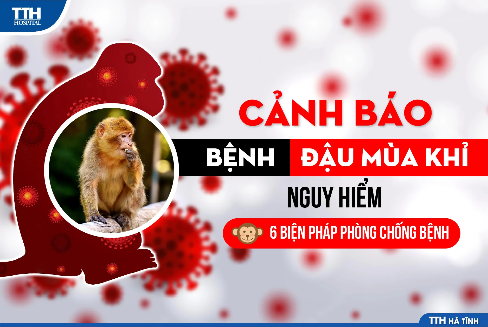 Bộ Y tế hướng dẫn triệu chứng nghi ngờ và cách phòng bệnh đậu mùa khỉ