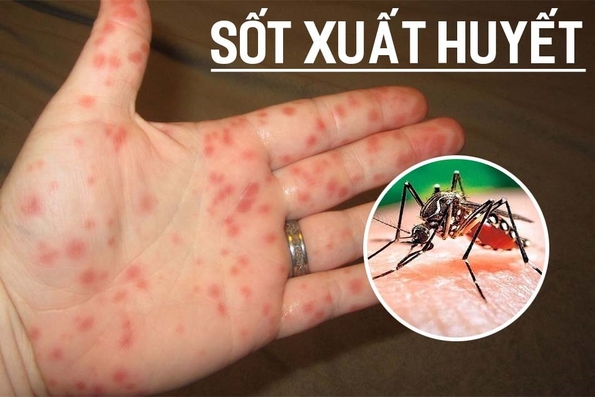 Khẩn trương thực hiện các biện pháp phòng chống dịch trong giai đoạn giao mùa